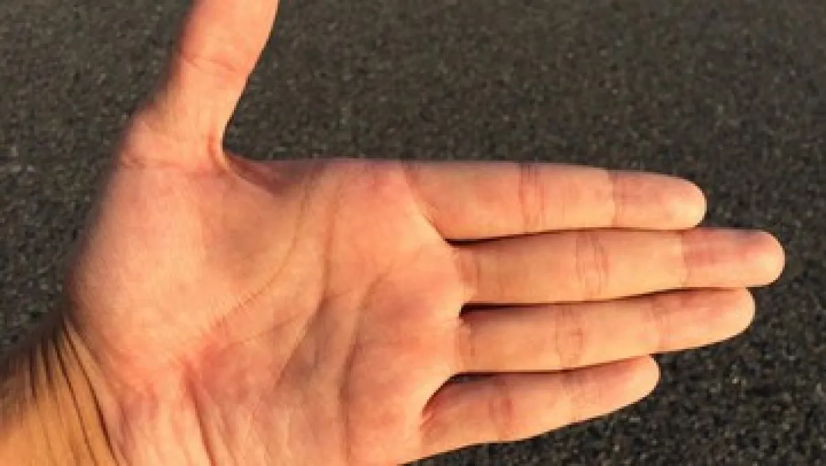thumb