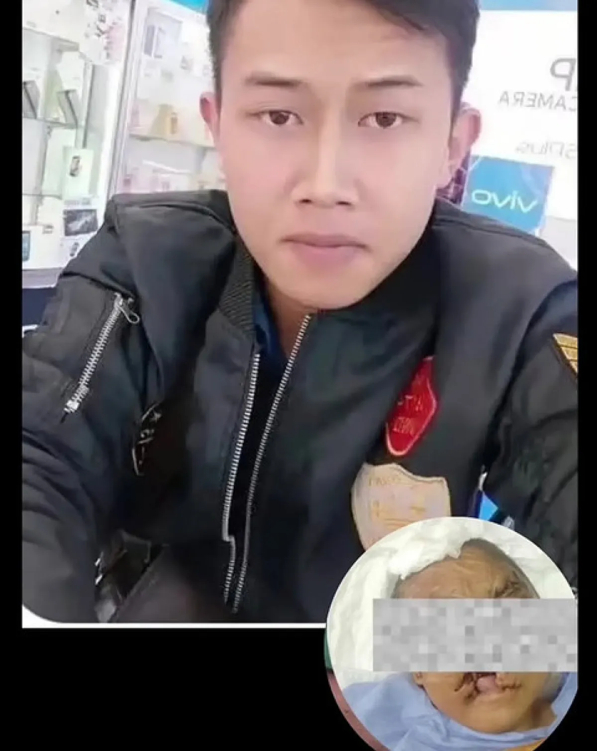 thumb