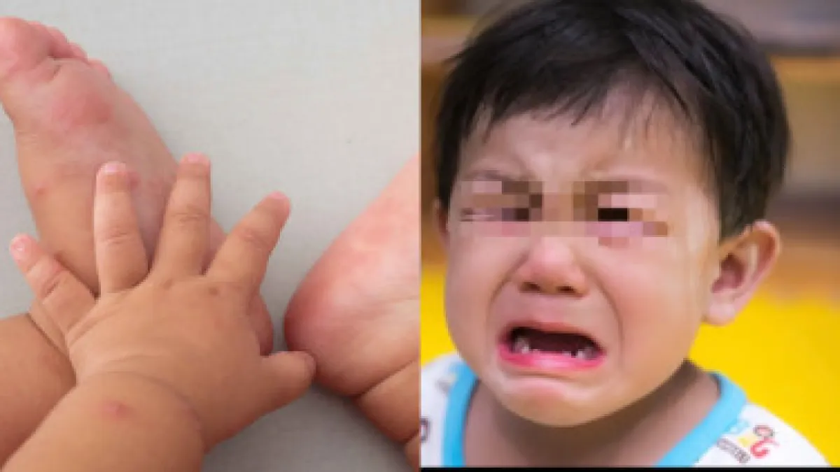 thumb