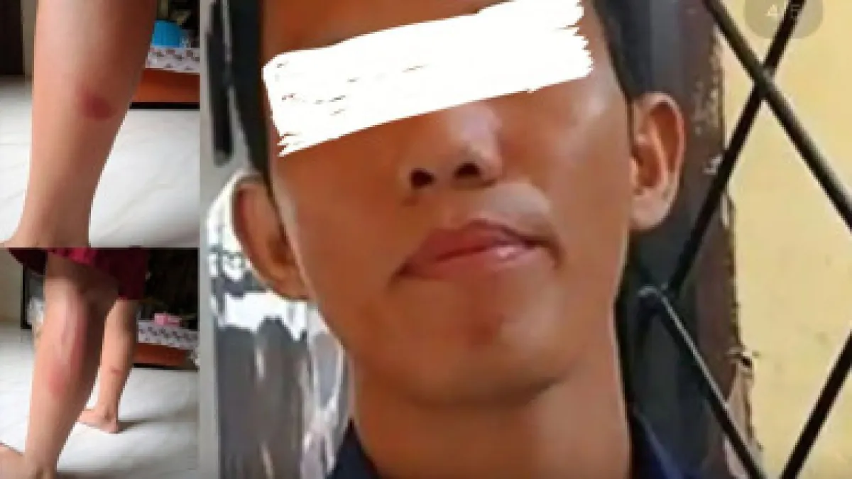 thumb