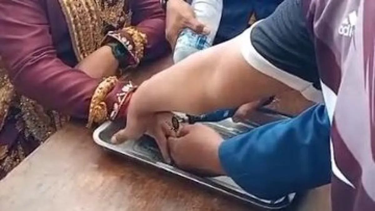 thumb
