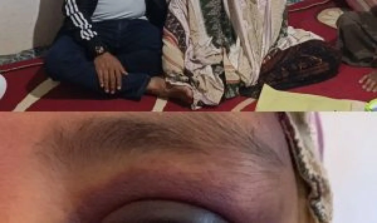 thumb