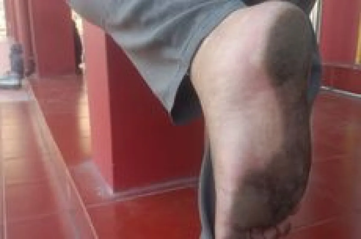 thumb